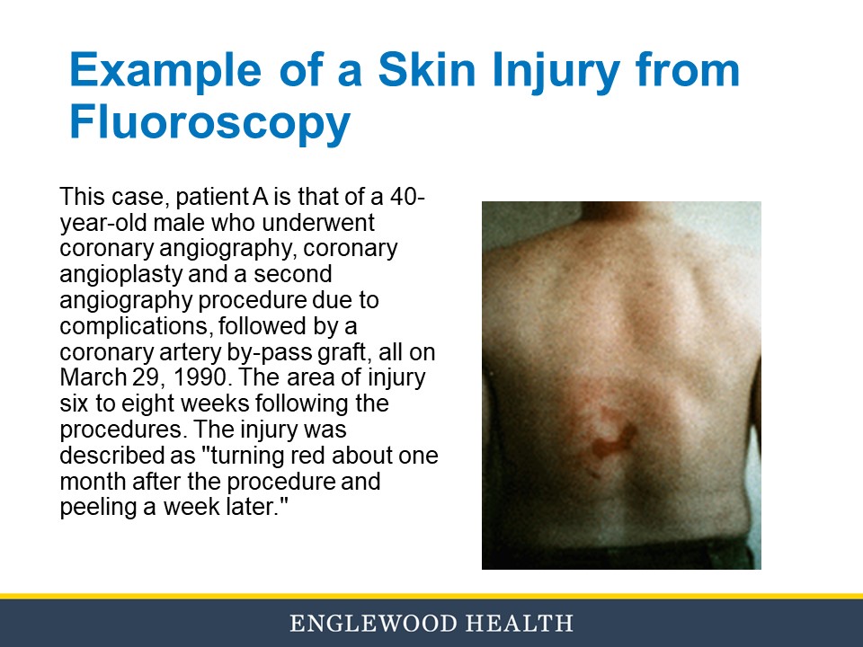 Fluoroscopy education slide 29