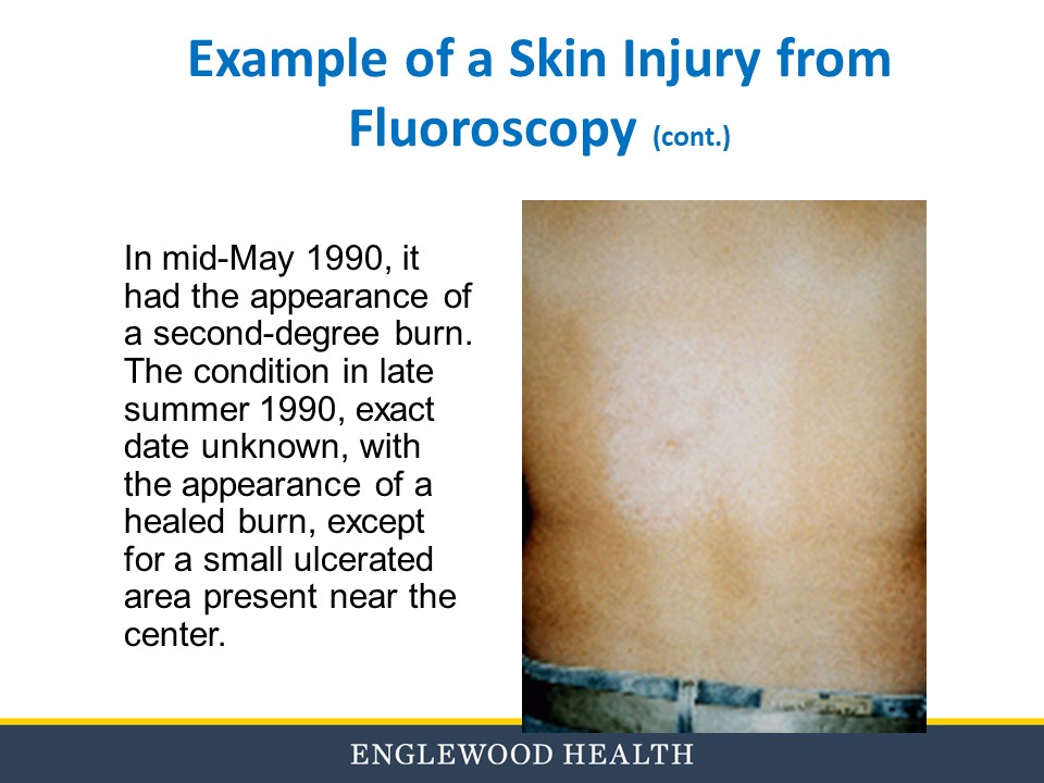Fluoroscopy education slide 30