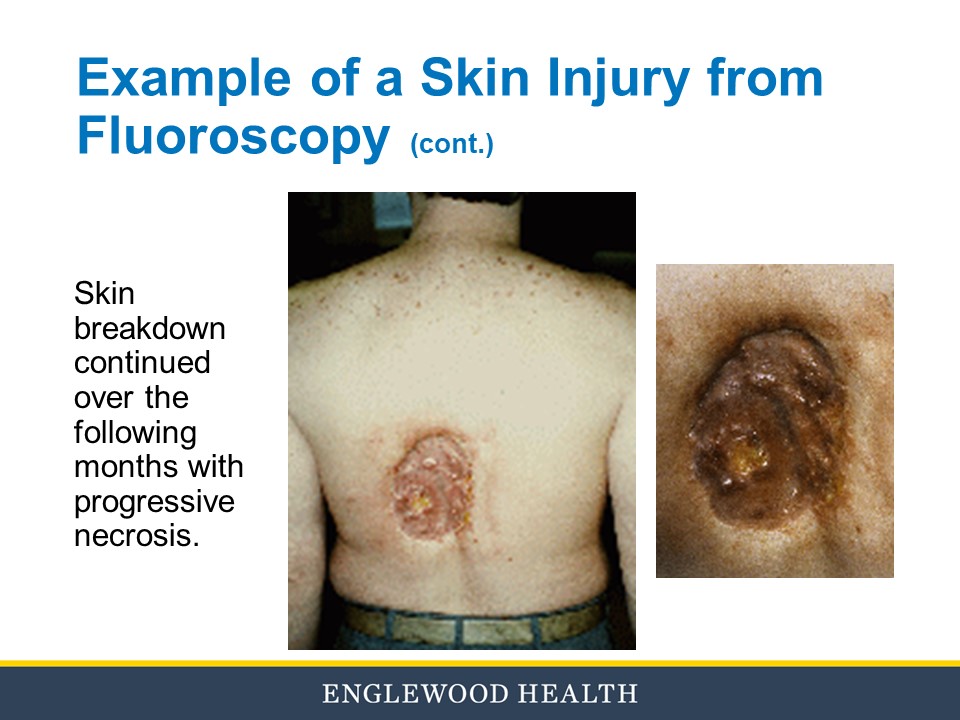 Fluoroscopy education slide 31