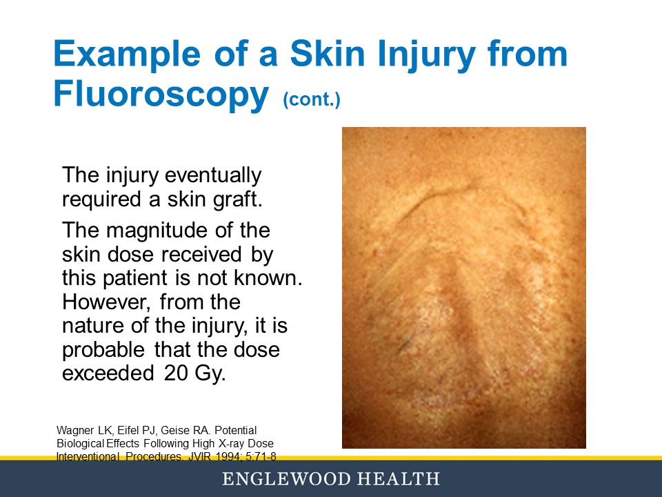 Fluoroscopy education slide 32