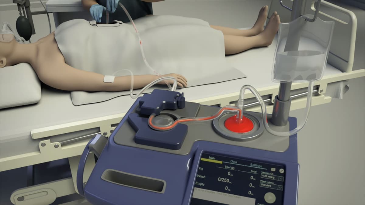 Play video now: Institute for Patient Blood Management and Bloodless Medicine and Surgery Patient Orientation