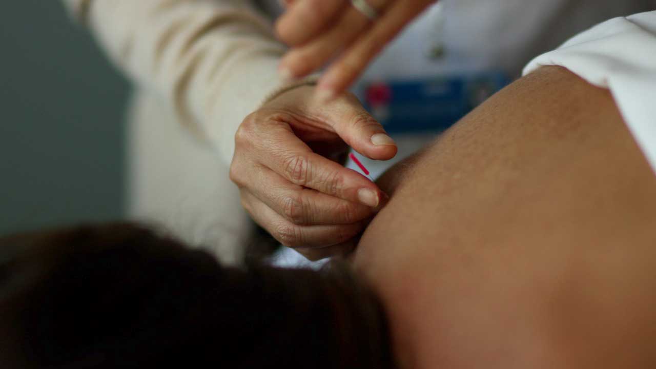 Video: Can Acupuncture balance hormones?