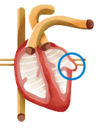 Illustration: Anatomy of the heart