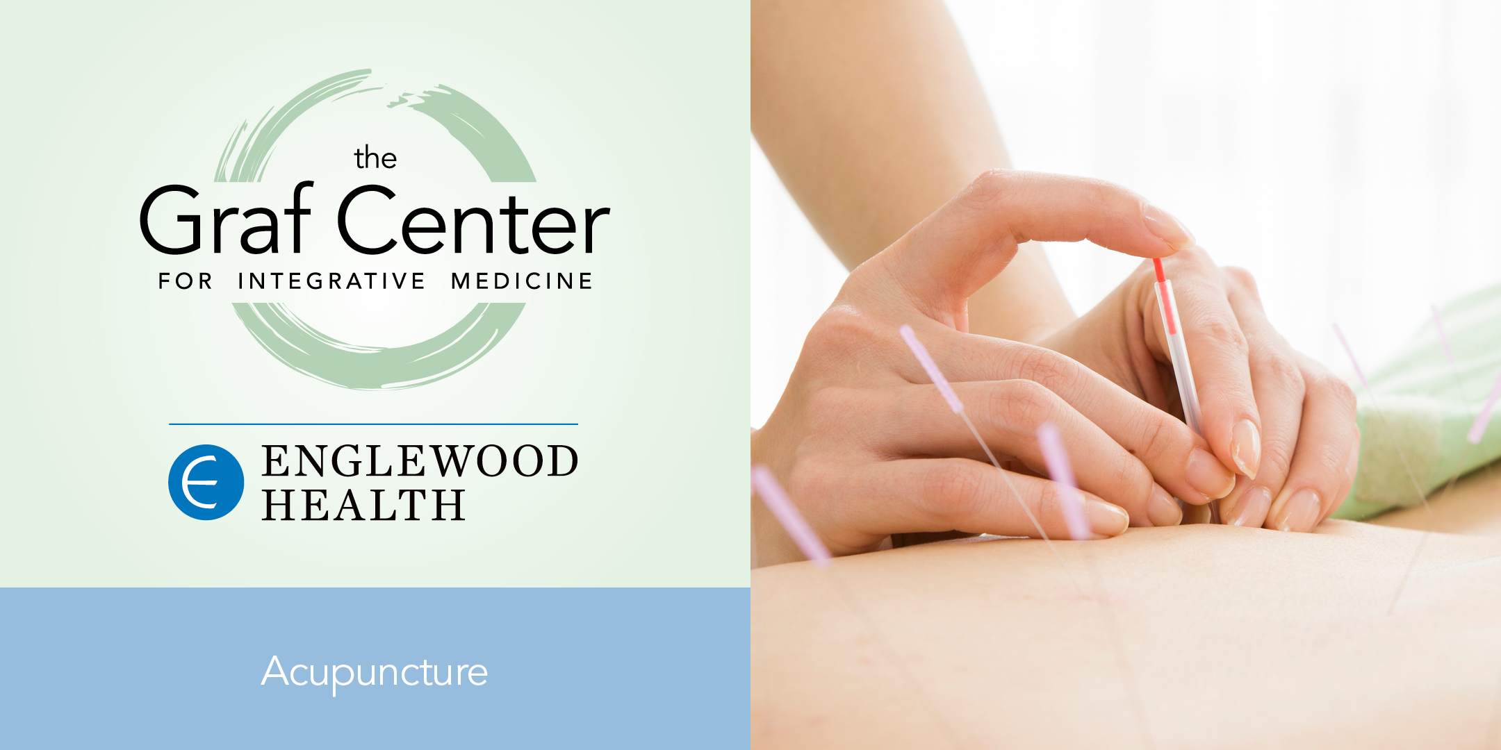 More info: Acupuncture for the Holidays: Stress Relief, Weight Loss, and Smoking Cessation